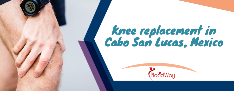 Knee replacement in Cabo San Lucas, Mexico